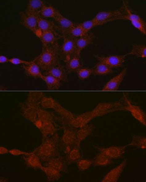 Anti-Gasdermin D antibody (GTX01070) | GeneTex