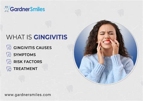 What is Gingivitis : Causes, Symptoms, Risk Factors and Treatment in 2023