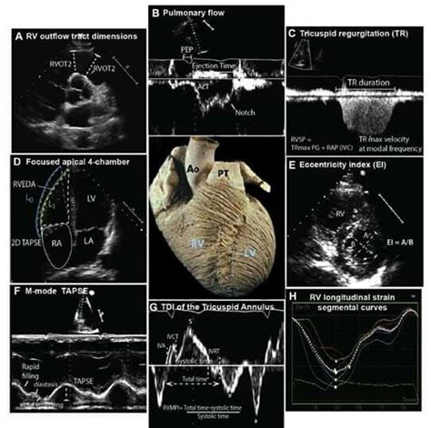 Pin by Johnelle Lee on Medical | Cardiac sonography, Ultrasound ...