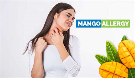 Mango Allergy - Symptoms, Causes, Prevention, Treatments, More