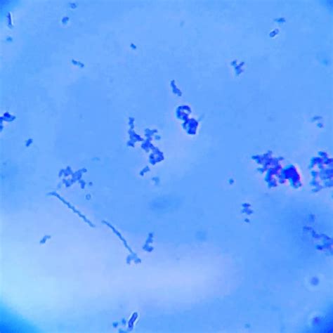 Treponema denticola : r/microbiology