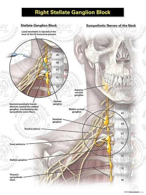 Male Right Stellate Ganglion Block