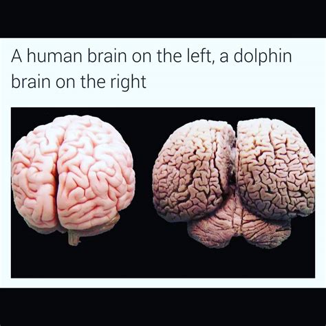 Human Brain vs Dolphins Brain | MedicosPlexus