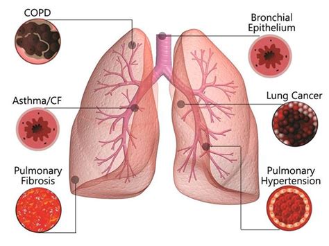 Rodent Respiratory Disease Models - Creative Biolabs | Respiratory diseases, Respiratory ...