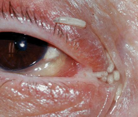 The 10 Most Disgusting Medical Conditions - Gallery | eBaum's World