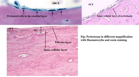 [Figure, Periosteum under different magnification power ...