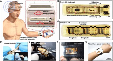 SID wirelessly integrated with wearable devices. (A) Schematic ...