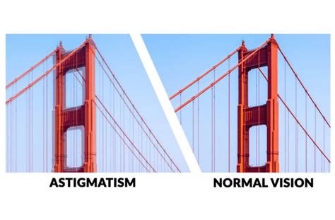 Does Astigmatism Affect Depth Perception?