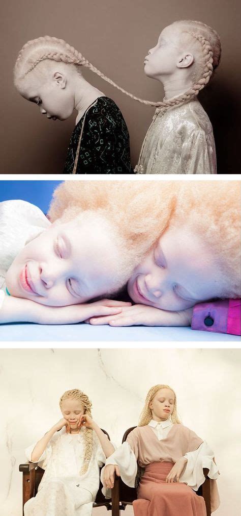 21 Best Albino twins, Lara and Mara images | Albino twins, Albinism, Albino