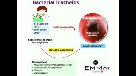 💠 Bacterial tracheitis 💠 - YouTube