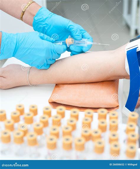 Blood drawing from vein stock photo. Image of care, paramedical - 26008652