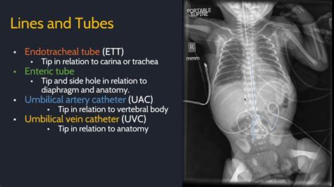 Approach to pediatric radiology - YouTube