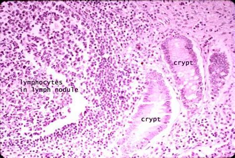 Appendix Histology