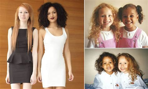 World’s 1st Twins With Different Skin Colors Are Already Adults: See How They Look Now ...