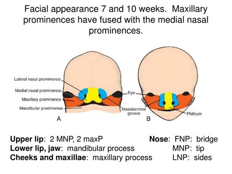 PPT - Craniofacial and Pharyngeal Arch Development PowerPoint Presentation - ID:2139368