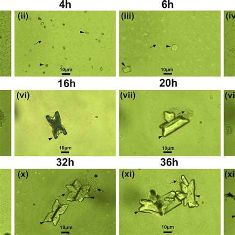 Temporal growth pattern of struvite crystals grown in artificial urine ...