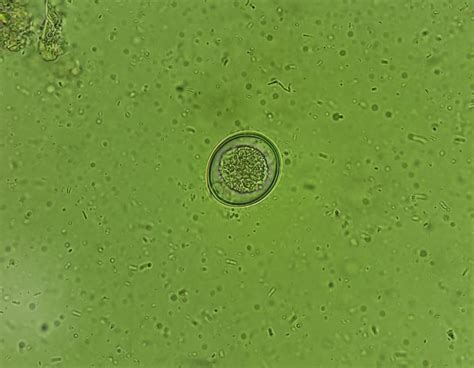 Coccidia Cystoisospora oocysts from puppy faecal sample : r/microscopy