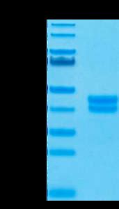 Biotinylated Human GPA33/A33 Protein (GPA-HM433B) from Kactusbio Inc. | Biocompare.com