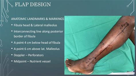 Free fibula flap OMFS 2021 journal club presentation