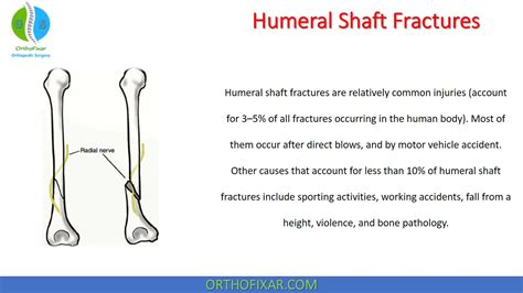 Mechanisms Of Humeral Head Fracture