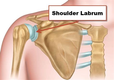 Shoulder Labral Tear - Motus Physical Therapy