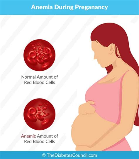 Diabetes and Anemia: Are They Related?