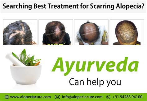 Scarring alopecia (Cicatricial alopecia) Treatment and Types.