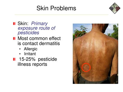 PPT - The Long Term Effects of Pesticide Exposure on Human Health An ...