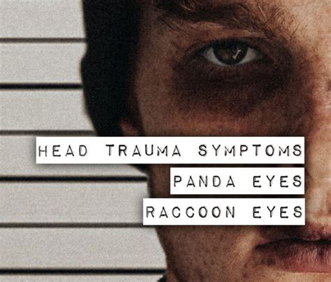 Symptoms of Panda eye - MEDizzy