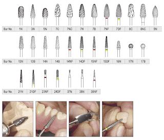 Premiere Dental: Carbide Burs