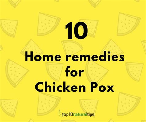 10 easy home remedies for chicken pox prevention - Top10 Natural Tips