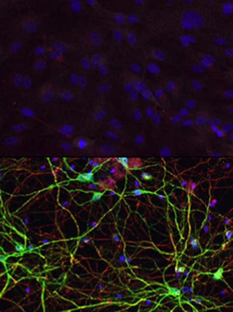 Human Skin Cells Reprogrammed Directly into Brain Cells - Neuroscience News