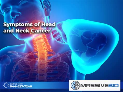 Symptoms of Head and Neck Cancer - Massive Bio