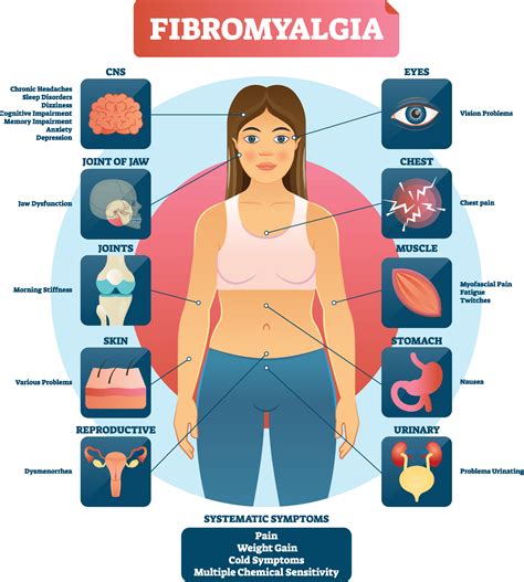 fibromyalgia tender points – Adam Sewell MD Blog