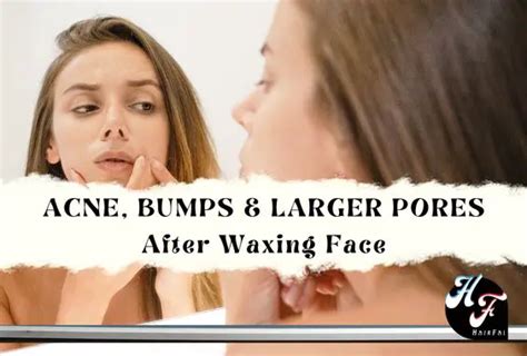 Does Face Waxing Cause Acne, Bumps, & Larger Pores - Hair Fai