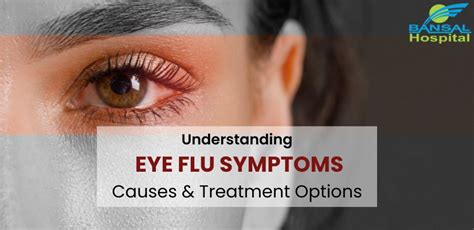 Understanding Eye Flu Symptoms, Causes And Treatment Options