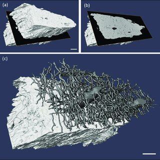 A sketch of an osteocyte section with its lacuna and canaliculi and... | Download Scientific Diagram