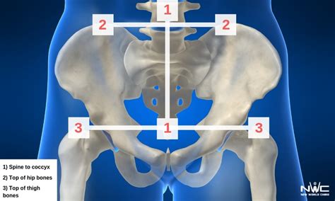 What Does It Mean When Your Hips Are Out Of Alignment?