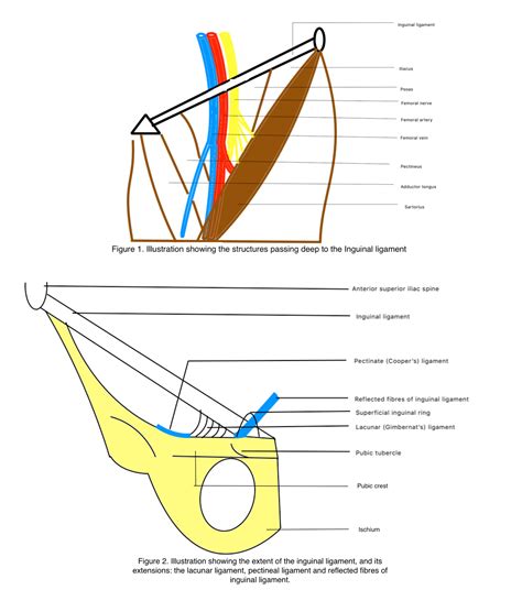 Lacunar Ligament Cadaver