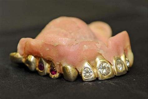 128 best images about Gold teeth on Pinterest