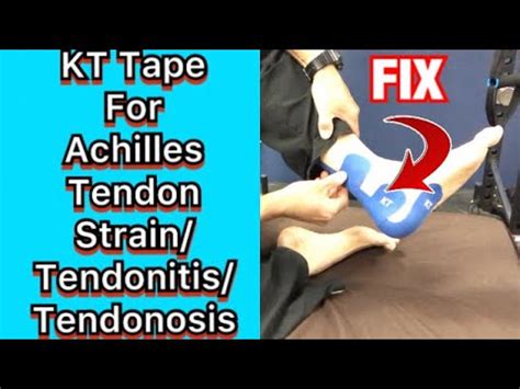 How To KT Tape For Achilles Tendon Strain/Tendonitis/Tendonosis! | Dr K ...