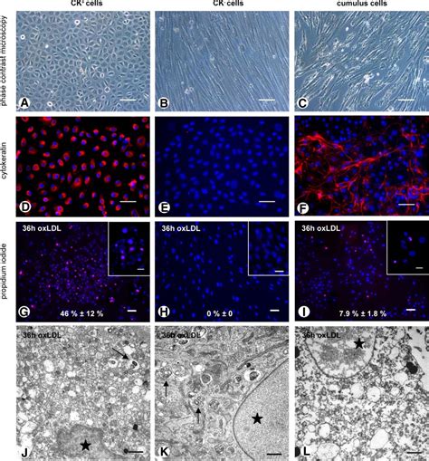 Cultures of three granulosa cell types are studied by phase contrast... | Download Scientific ...