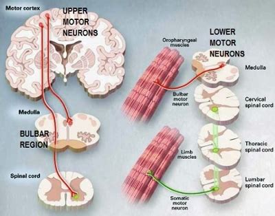 Why Do Lower Motor Neuron Lesions Cause Fasciculations | Webmotor.org