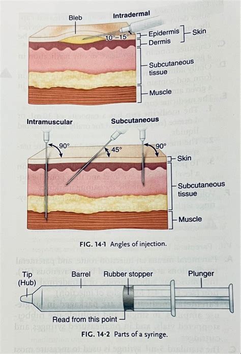 1st diagram is an intradermal injection. Angle of insertion is 10-15 ...