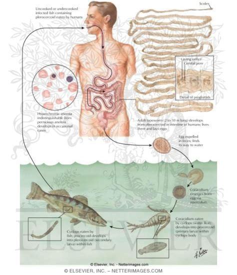 Parasitic Diseases IX - Diphyllobothriasis