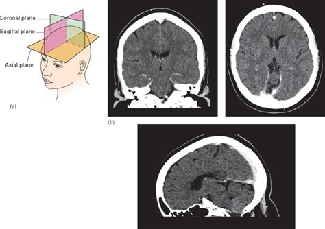 Axial Plane Brain