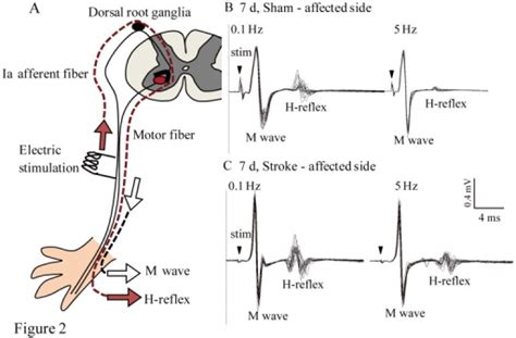 The RDD of the H reflex.A: An illustration of the H ref | Open-i