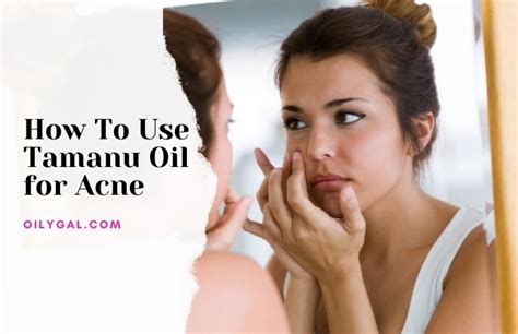 How to Use Tamanu Oil for Acne and Skin Blemishes - Simple Techniques ...