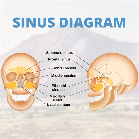 Sinus Diagram | Sinus relief, Sinusitis, Sinus problems