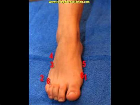 foot pain side of foot - YouTube